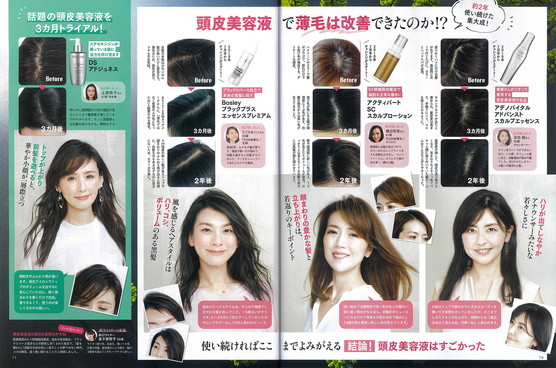 美ST 4月号」でSCスカルプローションが紹介されました。 – ACTIVART 