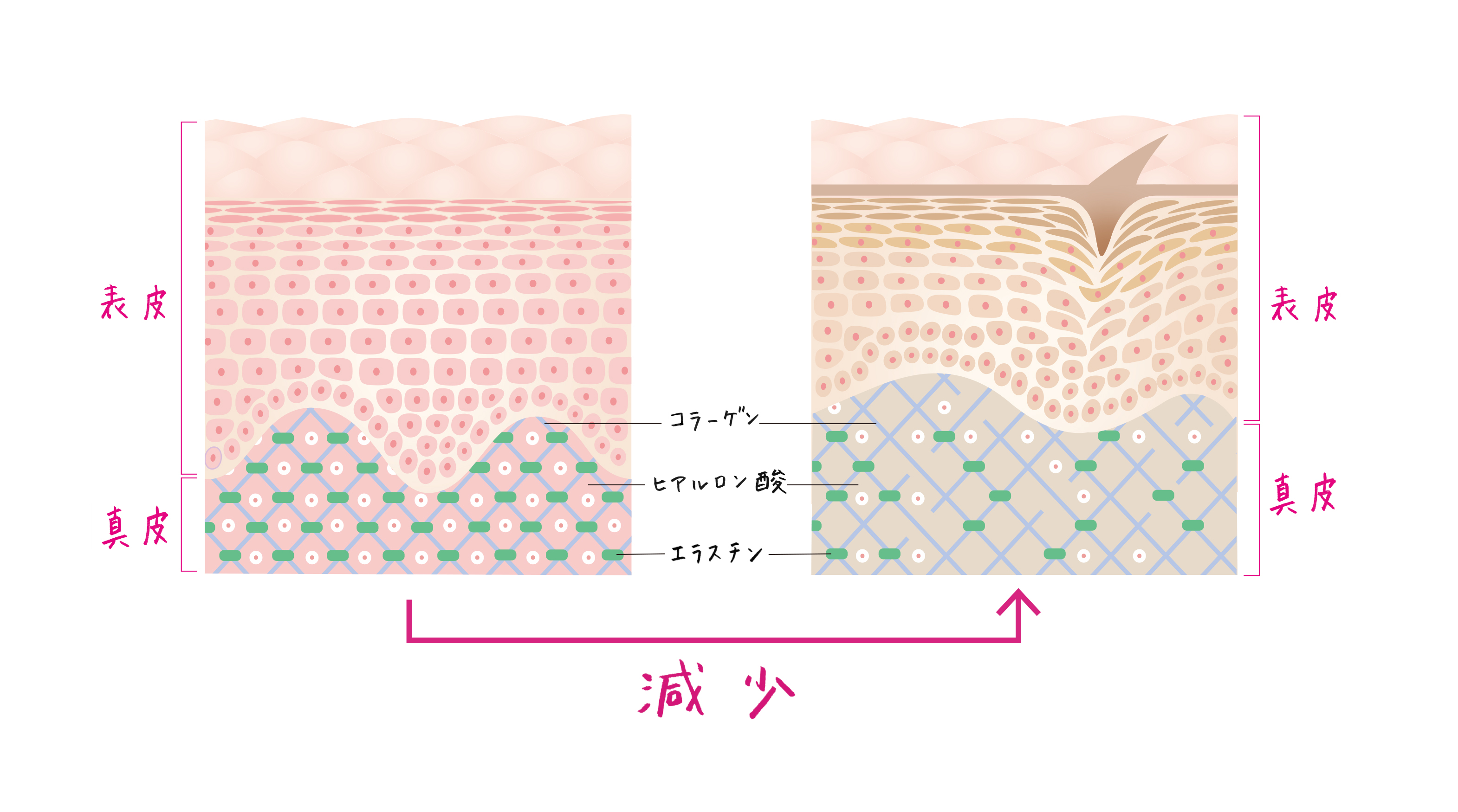 放っておくとこわいたるみ毛穴 その原因と対策とは Activart アクティバート